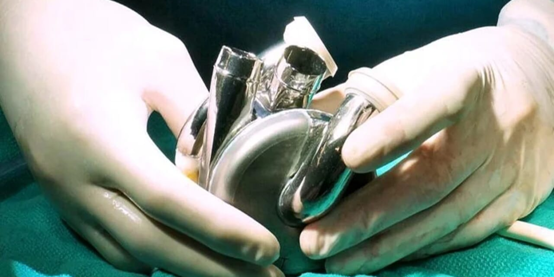 Un uomo è sopravvissuto 100 giorni con un cuore artificiale: è la prima volta